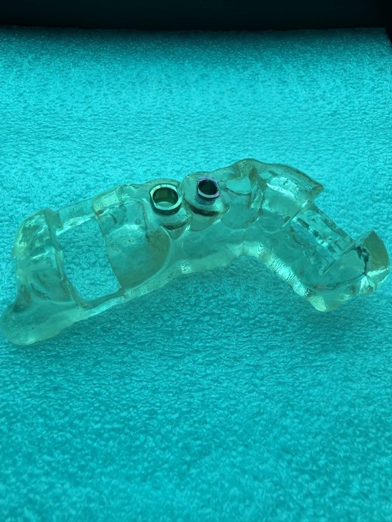 Guia Cirúrgico Impresso 3D
